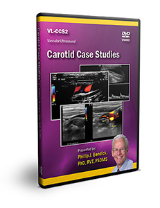 Carotid Case Studies - DVD