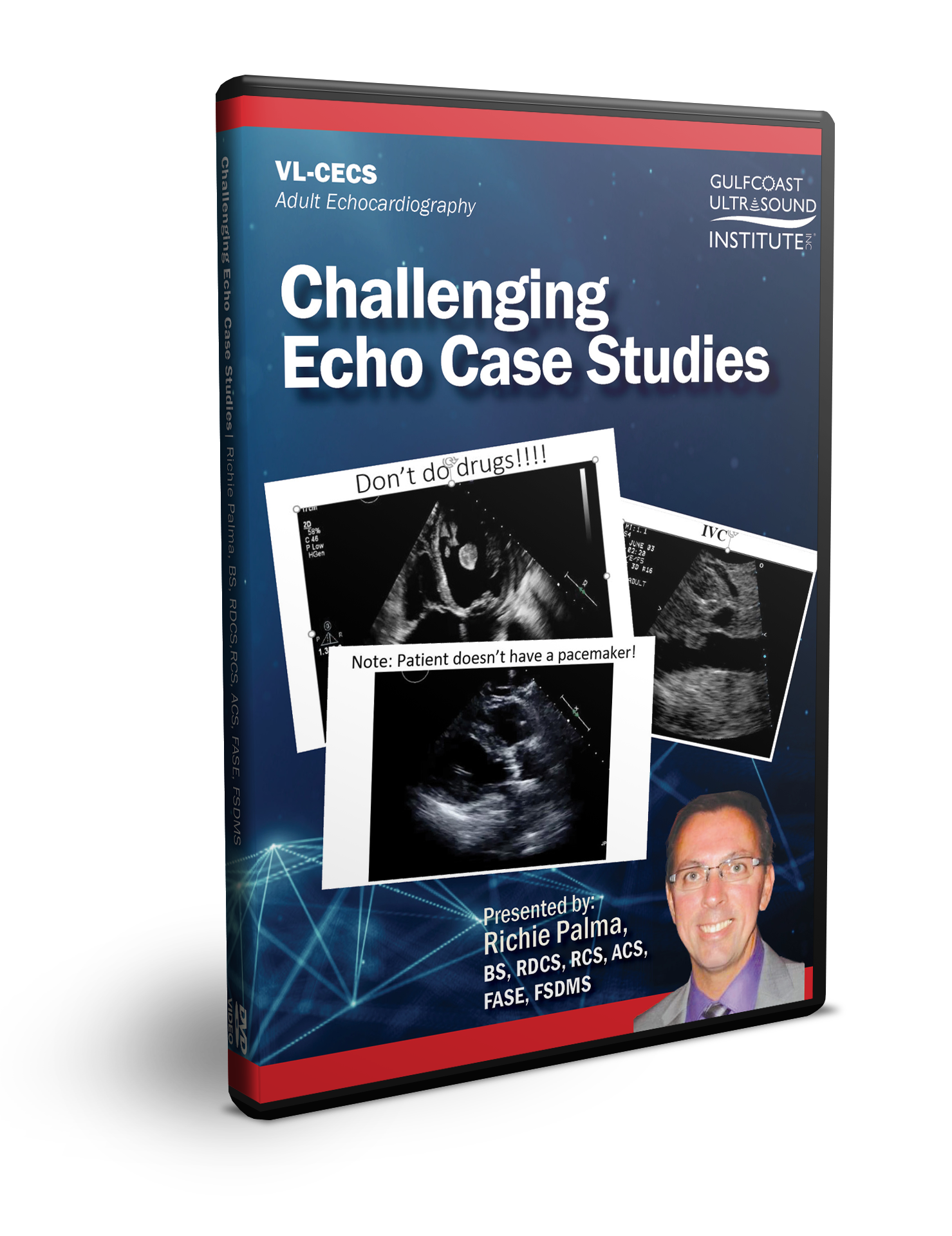 Challenging Echo Case Studies - DVD