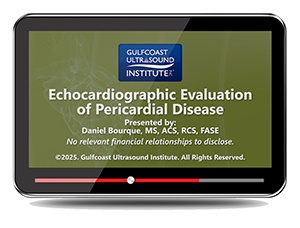Echocardiographic Evaluation of Pericardial Disease