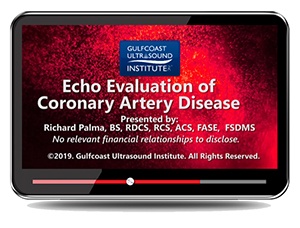 Echocardiographic Evaluation of Coronary Artery Disease