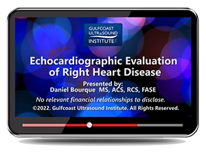 Echocardiographic Evaluation of Right Heart Disease