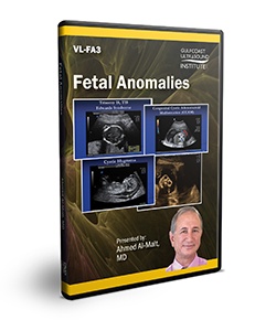 Fetal Anomalies - DVD