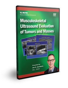 MSK Ultrasound Evaluation of Tumors and Masses - DVD