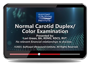 Normal Carotid Duplex/Color Examination