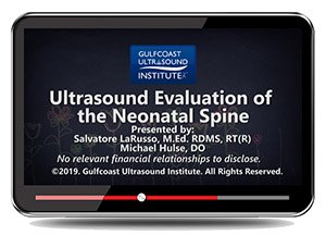 Ultrasound Evaluation of the Neonatal Spine