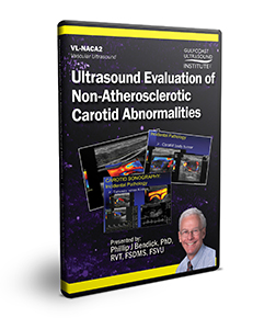 Ultrasound Evaluation of Non-Atherosclerotic Carotid Abnormalities - DVD