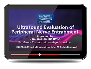 Ultrasound Evaluation of Peripheral Nerve Entrapment - Online Video