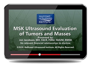 MSK Ultrasound Evaluation of Tumors and Masses