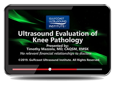 Ultrasound Evaluation of Knee Pathology