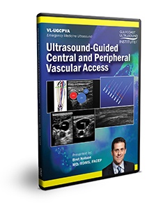 Ultrasound-Guided Central and Peripheral Vascular Access - DVD