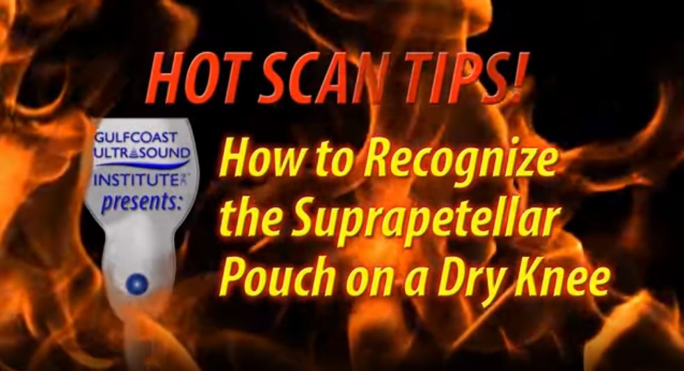 Hot Tip - How To Recognize The Suprapatellar Pouch On A Dry Knee