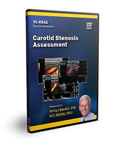 Carotid Stenosis Assessment - DVD