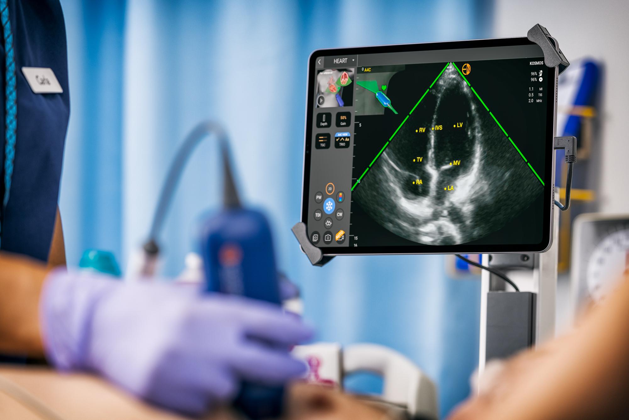 Understanding Adult Echocardiography
